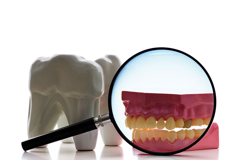Root Canal in Gladstone, North Kansas City
