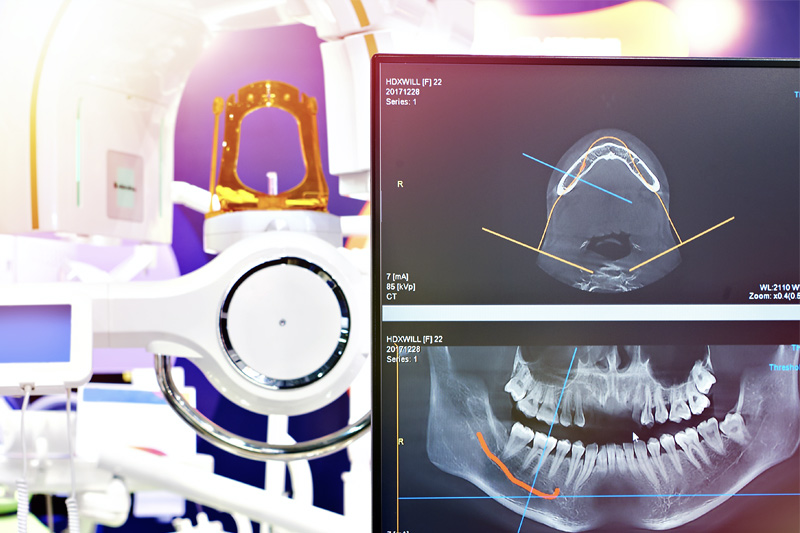 Digital X-Rays in Gladstone, North Kansas City