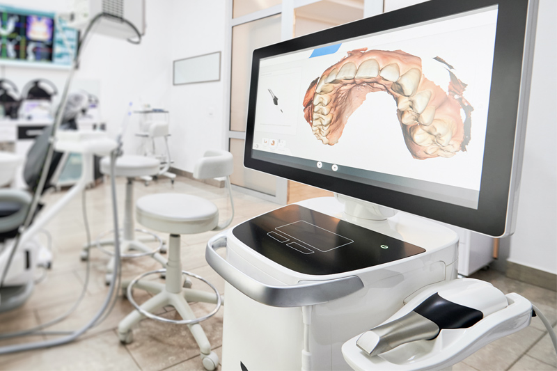 Intra-Oral Scanner in Gladstone, North Kansas City
